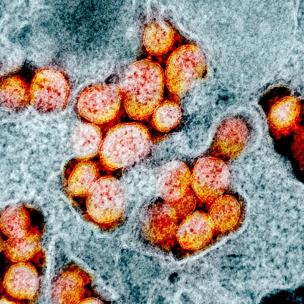 Transmission electron micrograph of SARS-CoV-2, or CCP virus particles, isolated from a patient. Image captured and color-enhanced at the NIAID Integrated Research Facility (IRF) in Fort Detrick, Maryland. (NIAID)