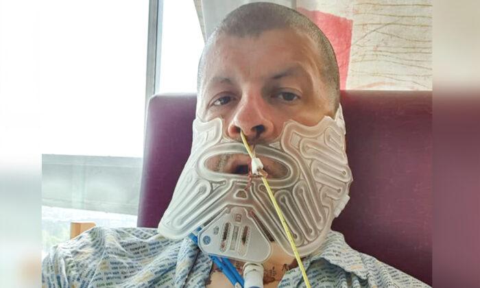 Man Who Hadn’t Been to a Dentist for 27 Years Has Jaw Removed After Fist-Sized-Tumor Diagnosis