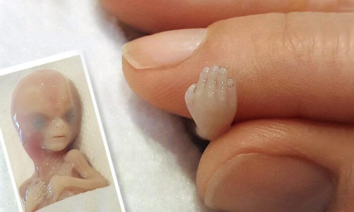Photos of ‘Perfectly Formed’ 14-Week Miscarried Baby Are Saving Lives: ‘He Was Not Medical Waste’