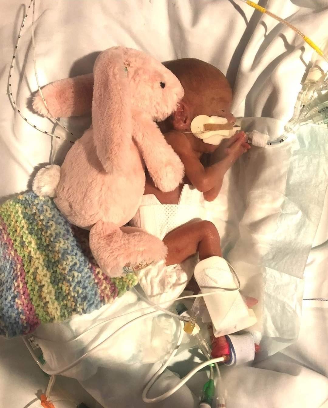 Isla in the NICU with her stuffed bunny. She was later gifted the same bunny on her birthday. (Courtesy of <a href="https://www.instagram.com/isla_of_adventure/">Jasmine Tobias</a>)